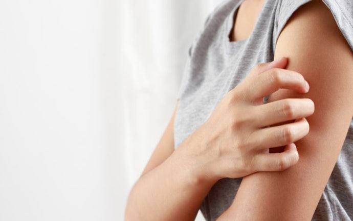 Itchy Skin? You May Need A Liver Detox
